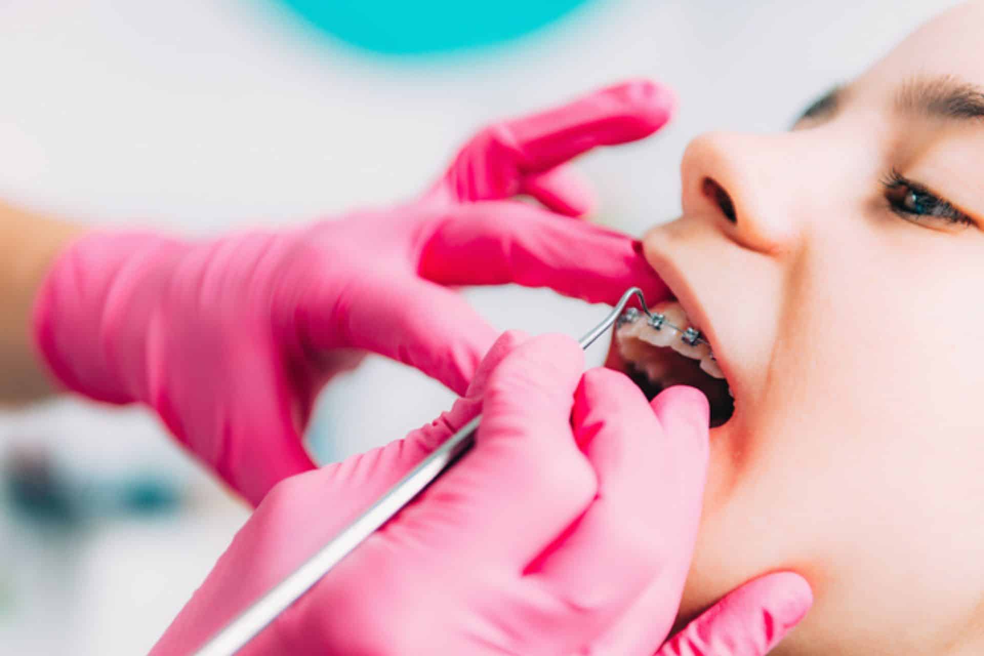 Do Braces Hurt? What to Expect During Treatment David Ross Orthodontics in Hanover, PA, Lutherville-Timonium, and Westminster, MD