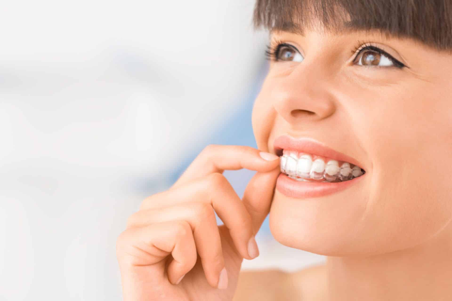 Can You Get Invisalign If You Have Cavities or Crowns? David Ross Orthodontics in Hanover, PA